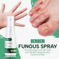 Hand Ringworm Beriberi Fungus Spray